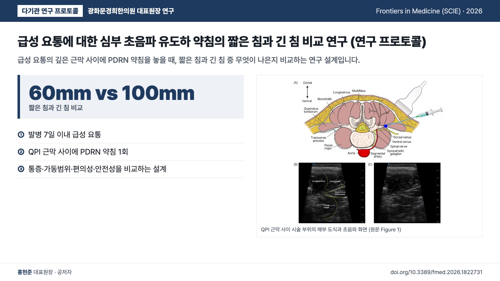 급성 요통에 대한 심부 초음파 유도하 약침의 짧은 침과 긴 침 비교 연구 (연구 프로토콜) — 급성 요통의 깊은 근막 사이에 PDRN 약침을 놓을 때, 짧은 침과 긴 침 중 무엇이 나은지 비교하는 연구 설계입니다.